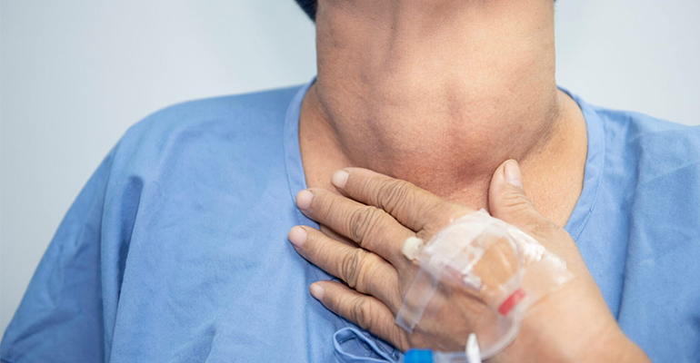 Thyroid Surgery
